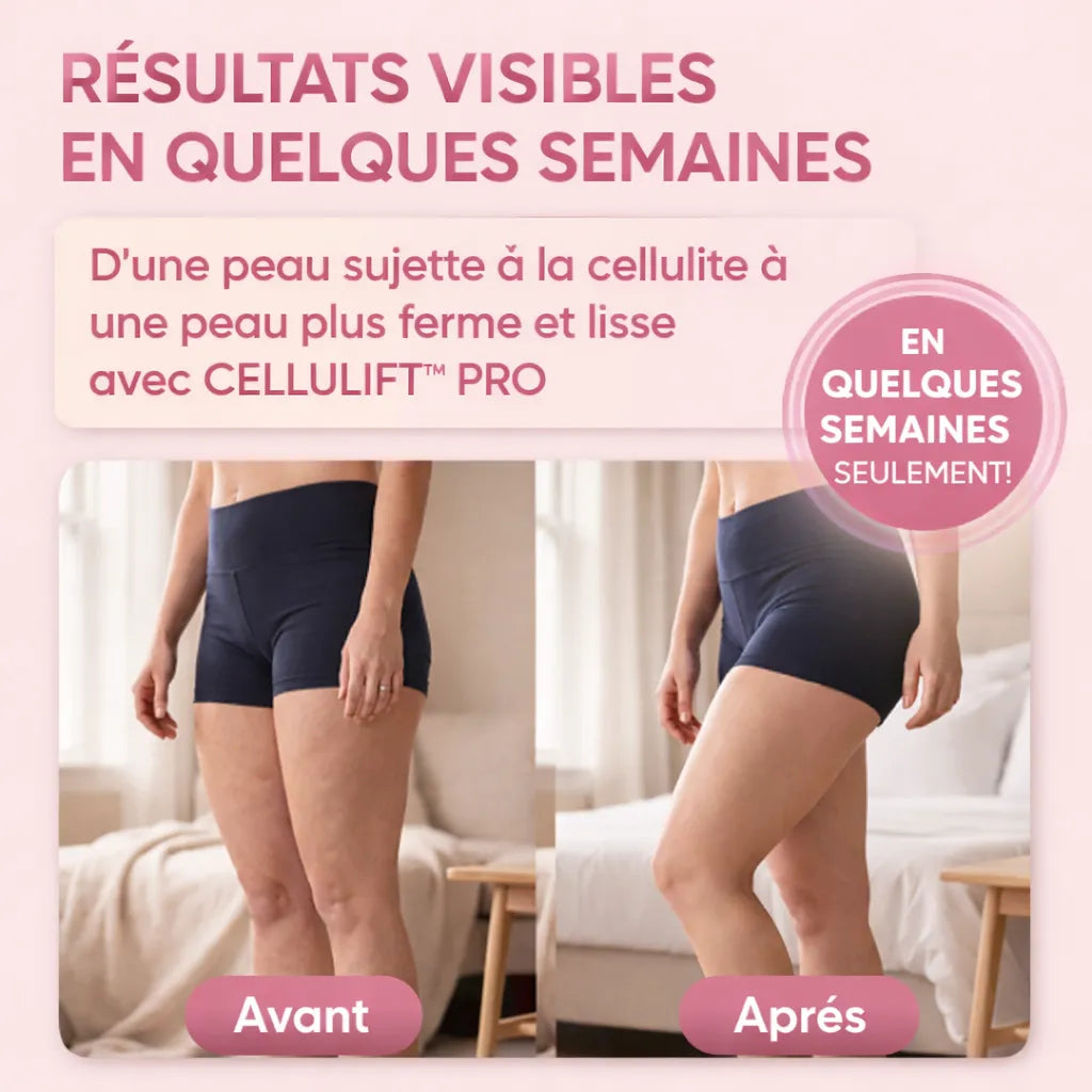 CelluLift™ Pro — Raffermissez votre peau sans effort