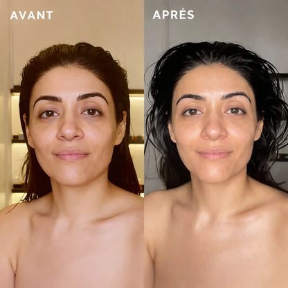 KIYORA™ ContourLift  - Sculpte votre visage en 3 minutes