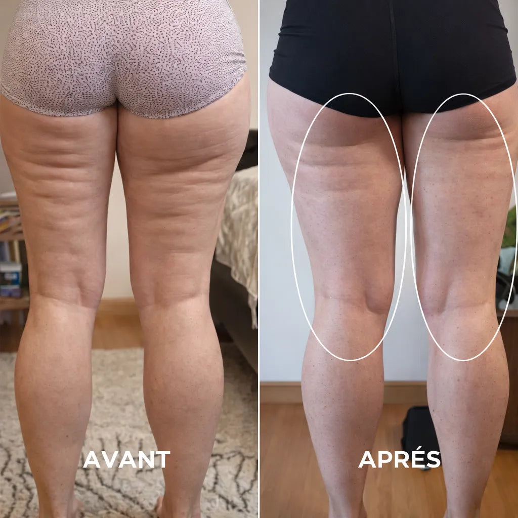 CelluLift™ Pro — Raffermissez votre peau sans effort