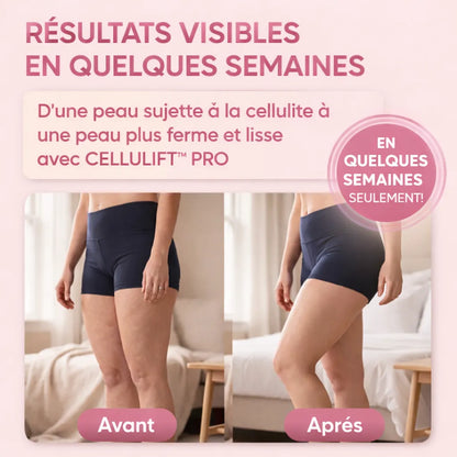 CelluLift™ Pro — Raffermissez votre peau sans effort