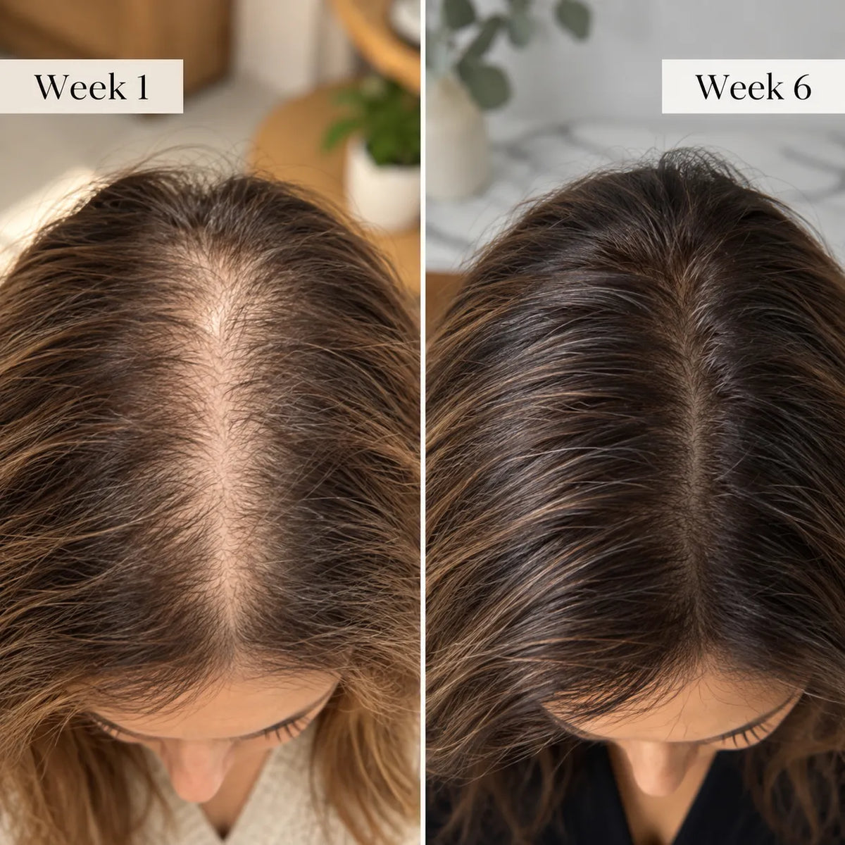 RENEW — Hair Micro-Infusion System