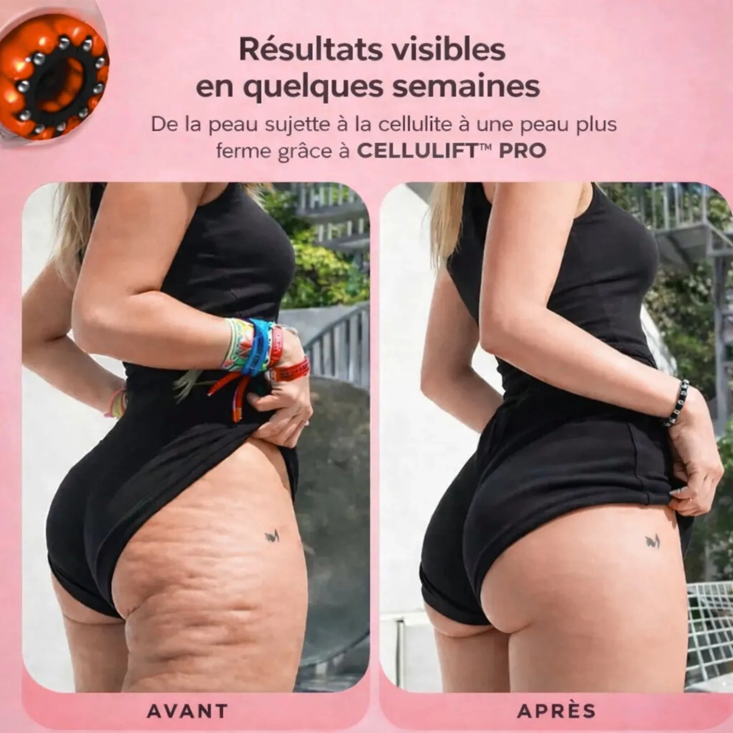 CelluLift™ Pro — Raffermissez votre peau sans effort