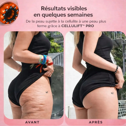 CelluLift™ Pro — Raffermissez votre peau sans effort