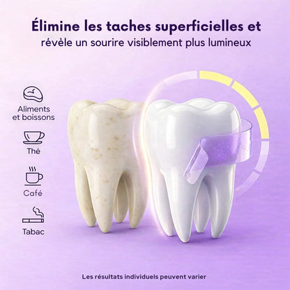 ULTRA WHITE BANDES BLANCHISSANTES