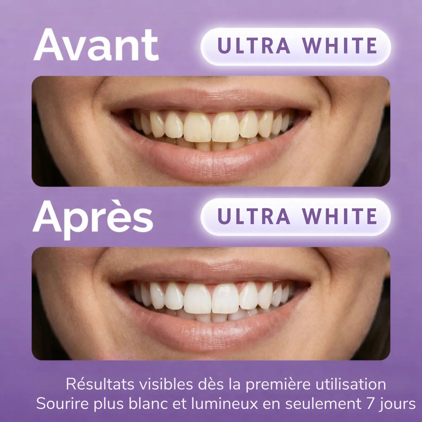 ULTRA WHITE BANDES BLANCHISSANTES