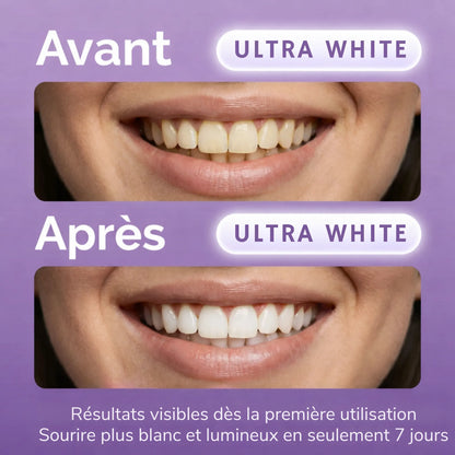 ULTRA WHITE BANDES BLANCHISSANTES