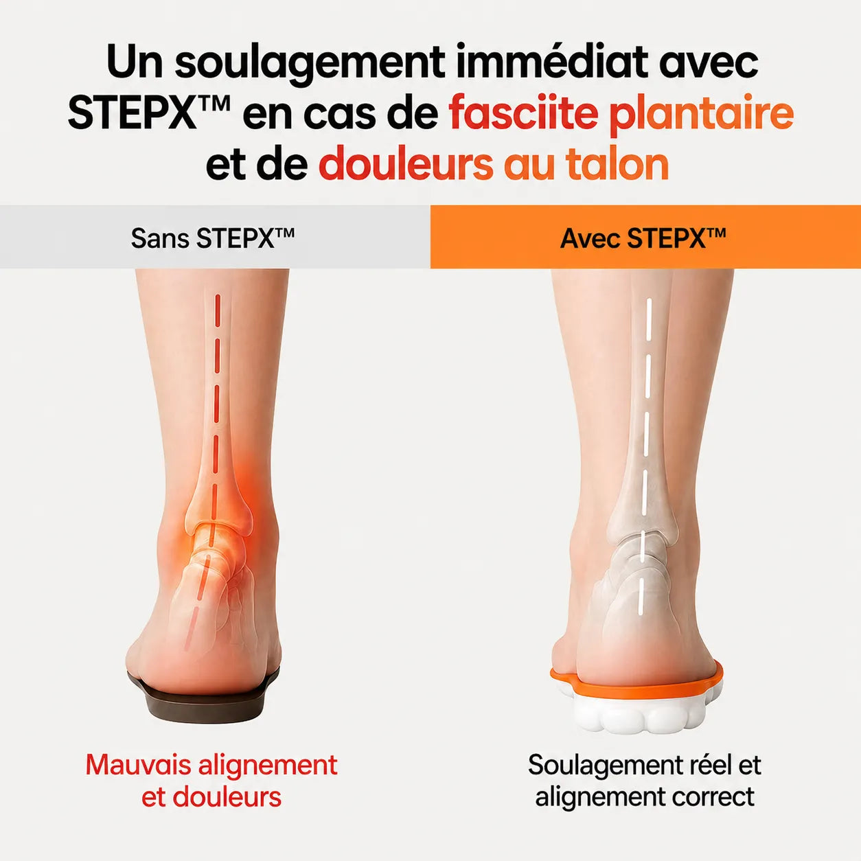 STEPX - Semelles orthopédiques pour soulager les douleurs au talon et la fasciite plantaire